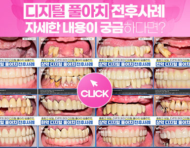 전후사례 팝업